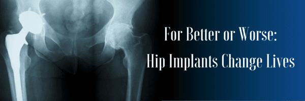 Hip X-ray